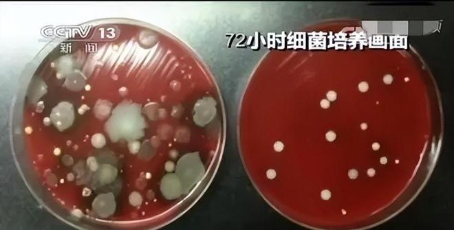 桶脏10倍仍有人每天用餐时仍不离手！EVO视讯央视已曝光！这个物品比马(图8)